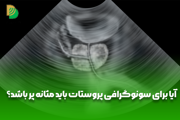 آیا برای سونوگرافی پروستات باید مثانه پر باشد؟