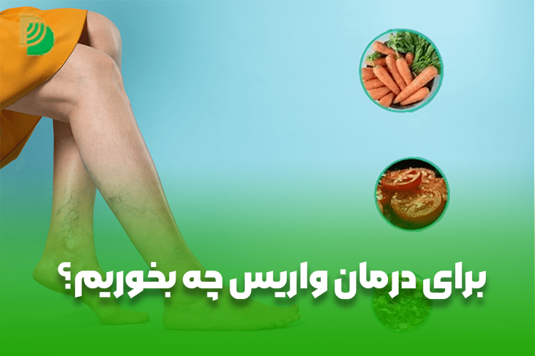برای درمان واریس چه بخوریم؟
