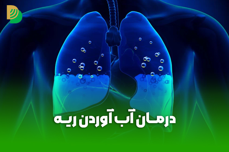 درمان آب آوردن