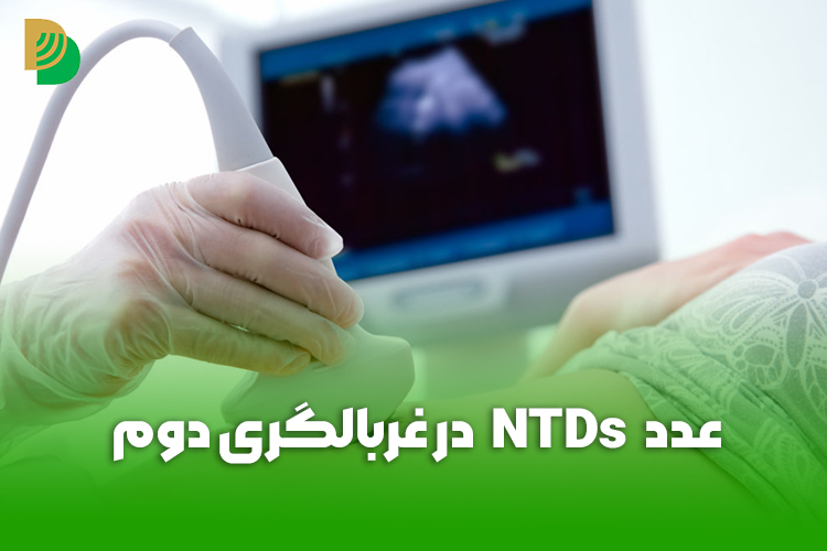 عدد NTDs در غربالگری دوم مهم است یا خیر؟